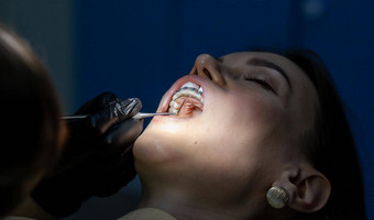 女人牙医的任命取代拱门牙套