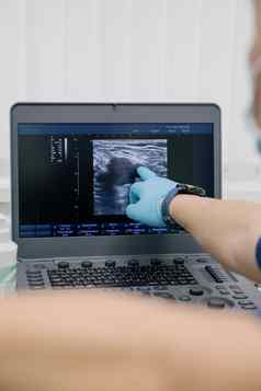 医生超声波设备研究条件静脉现代超声波监控