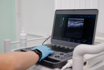 医生超声波设备研究条件静脉现代超声波监控