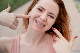 年轻的红发女人牙套牙齿点微笑在户外夏天