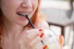 年轻的美丽的红发女人牙套饮料冷却柠檬水在户外夏天肖像微笑女孩雀斑
