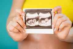 特写镜头认不出来怀孕了女人持有超声波扫描肚子背景孕妇母亲怀孕爱双胞胎概念