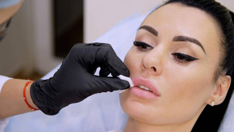 医疗办公室医生黑色的无菌手套注射透明质酸酸病人嘴唇过程增加体积嘴唇修正嘴唇形状
