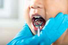 医生检查口服腔孩子口镜子检查牙齿腔