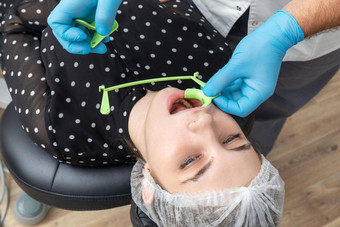 牙医安装病人脸颊牵开器牙医办公室