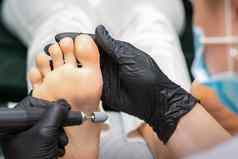 剥修脚过程唯一的愈伤组织女脚pedicurist美沙龙