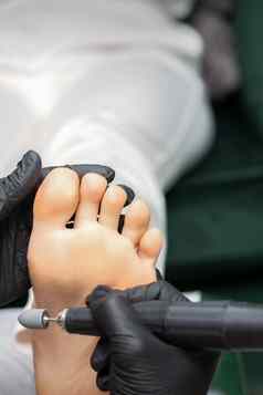 剥修脚过程唯一的愈伤组织女脚pedicurist美沙龙