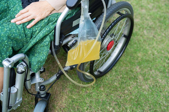 亚洲夫人女人病人坐着轮椅尿液<strong>袋</strong>医院病房健康的医疗概念