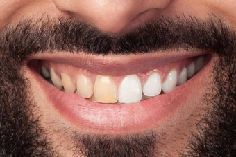 女人牙齿<strong>美白</strong>快乐微笑女人牙科健康概念口服护理概念