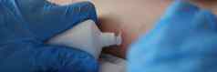 医生检查红色的皮疹孩子腿医院应用奶油管