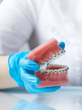 医生牙齿矫正医师显示模型人类下巴线牙套附加