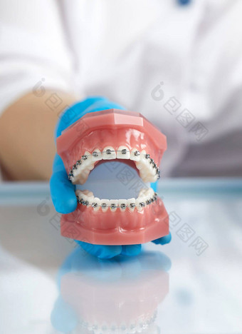 医生<strong>牙齿矫正</strong>医师显示模型人类下巴线牙套附加