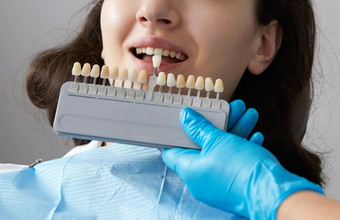 牙医选择颜色牙搪瓷病人牙医应用样本牙搪瓷<strong>规模高</strong>加索人女牙齿