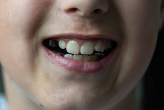 女孩转移齿列演示了牙齿