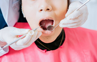 牙医检查病人口牙科镜子特写镜头病人检查牙医特写镜头牙医的手检查病人的口牙医执行口腔学