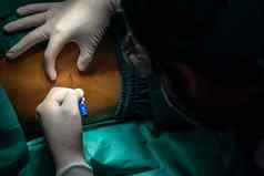 外科医生注入麻醉无菌注射器病人手术