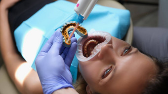 牙齿矫正医师作品形状下巴投过程假肢面部拱女人