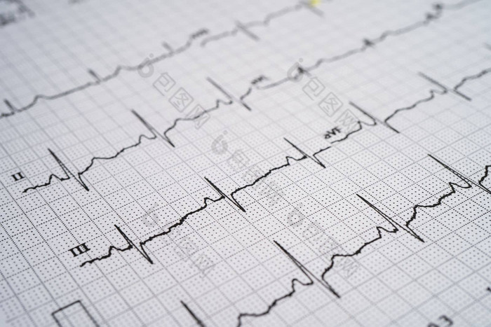 心电图心电图红色的心心波心攻击心电图报告