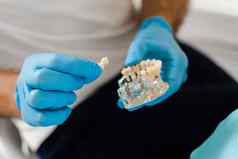 人工塑料下巴牙科植入物特写镜头牙科假肢植入物牙科假肢咨询牙医病人女人牙科