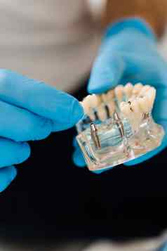 人工塑料下巴牙科植入物特写镜头牙科假肢植入物牙科假肢咨询牙医病人女人牙科