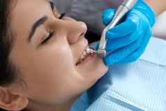 年轻的女人牙齿抛光牙科诊所专业牙科清洁概念