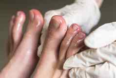 科维德脚趾冠状病毒症状肿胀变色紫色颜色疼痛粗糙的皮肤