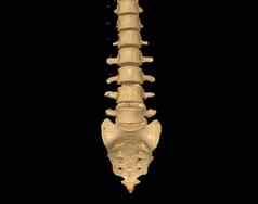 扫描腰椎脊柱呈现显示配置文件人类脊柱