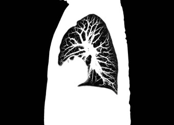 <strong>扫描</strong>胸部肺放射学部门医院科维德<strong>扫描</strong>身体x光测试检测科维德病毒疫情传播概念