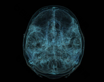 人类头骨大脑扫描x射线可视化内部头骨插图渲染
