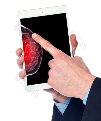 医生数字平板电脑x射线数字乳房x光检查孤立的白色背景