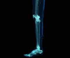 渲染较低的肢体腿孤立的黑色的背景