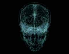 人类头骨大脑扫描x射线可视化内部头骨插图渲染
