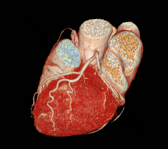 心脏进行合作。冠状<strong>动脉动脉</strong>预防筛选冠状<strong>动脉动脉</strong>疾病