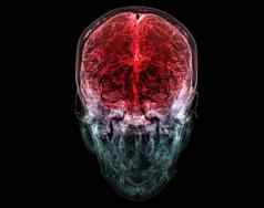 呈现医学上准确的插图脑动脉头