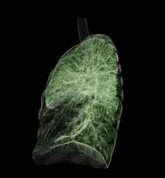 胸部肺呈现图像