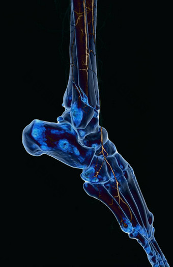 股动脉血管造影血管造影术较低的肢体区域
