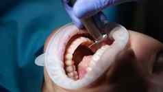 牙医治疗病人牙齿钻牙科诊所特写镜头