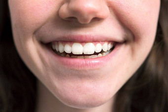 关闭美丽的微笑年轻的女人白色健康的牙齿
