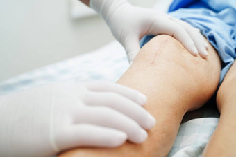 亚洲上了年纪的女人病人疤痕膝盖更换手术医院