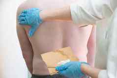 护士涂片身体覆盖过敏皮疹病人手医生涂片人的皮肤白色药膏