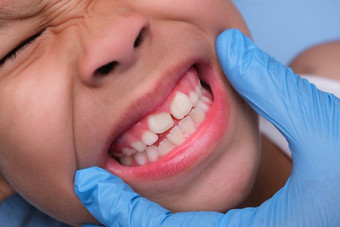 特写镜头内部口服腔健康的孩子美丽的行婴儿牙齿年轻的女孩打开口揭示上较低的牙齿硬口感软口感牙科口服健康检查
