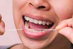特写镜头微笑亚洲女人清洁完美的微笑健康的白色牙齿用牙线清洁牙齿口服健康牙科护理