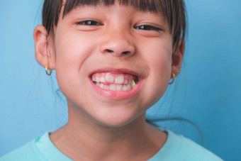 微笑可<strong>爱</strong>的女孩吃甜蜜的明胶糖添加孤立的蓝色的背景孩子们吃含糖的糖果导致损失<strong>牙</strong>齿<strong>牙</strong>衰变不健康的口服护理
