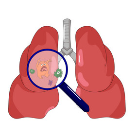 卡通手绘肺炎症状插画