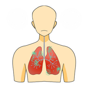 卡通手绘疫情肺炎症状插画