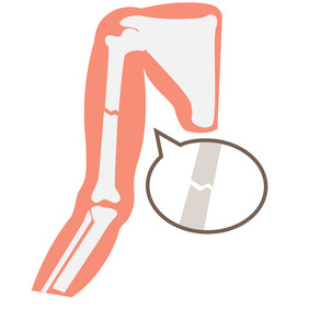 骨折受伤人体骨骼