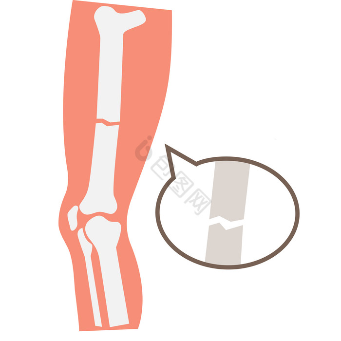 骨头图片-骨头素材免费下载-包图网