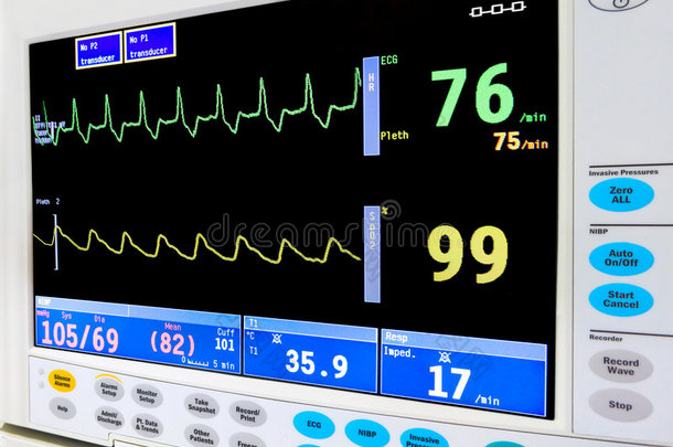 <strong>重症</strong>监护室心脏监护仪