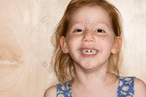 微笑的女孩露出她脱落的牙齿