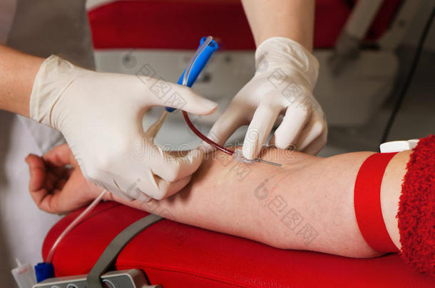 血液实验室献血的血液